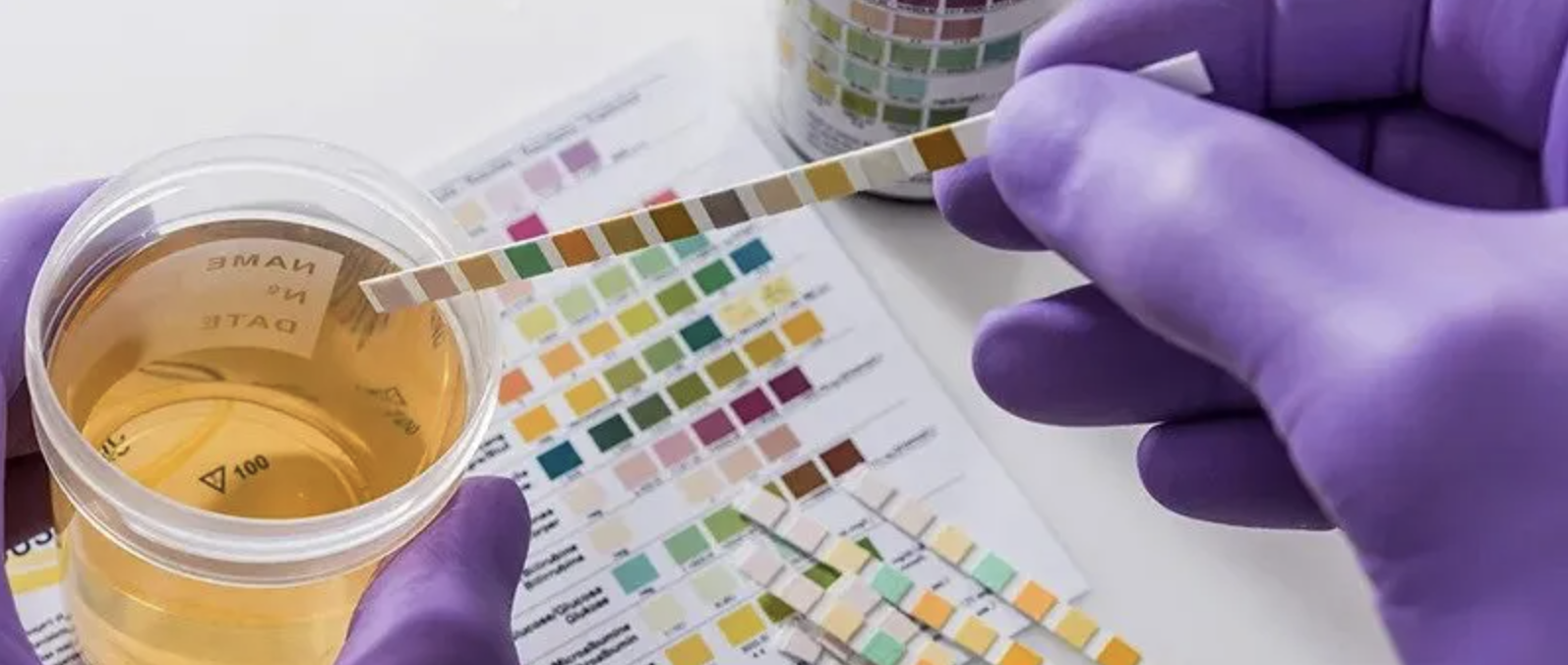 Unraveling the Truth: Can Fake Urine Be Detected In Drug Tests?